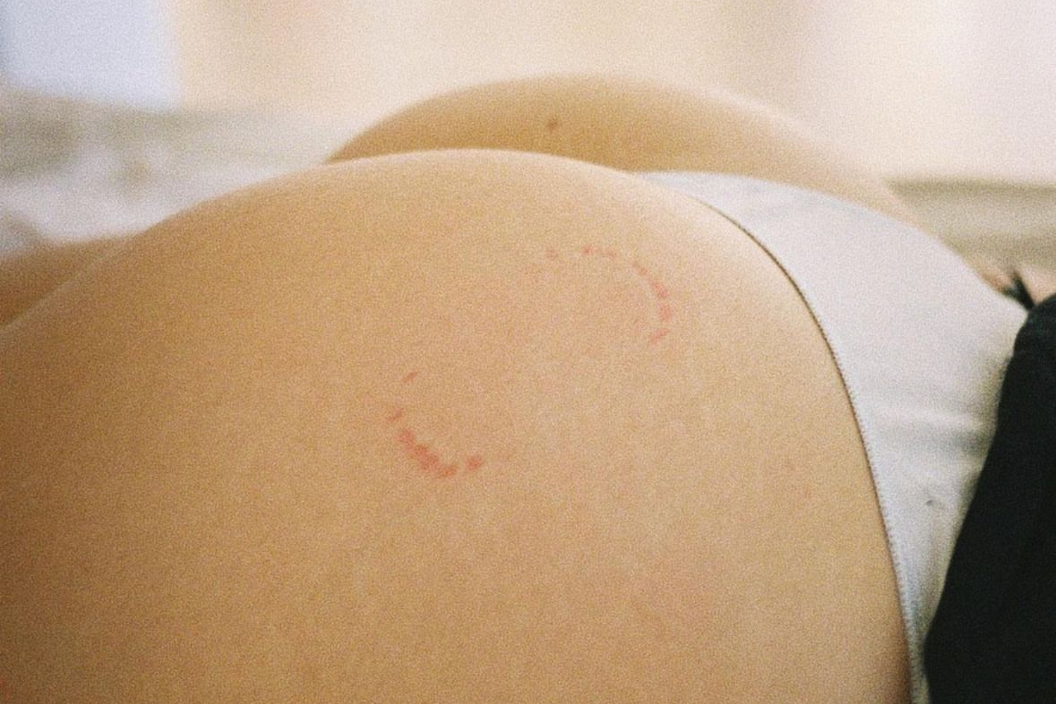 Sensual Biting as Playful Intimacy